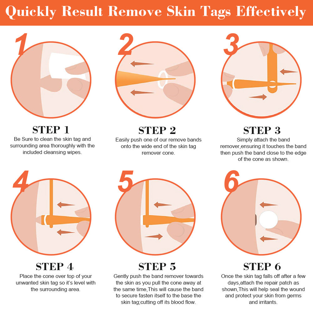 2 in 1 Skin Tag Removal Kit
