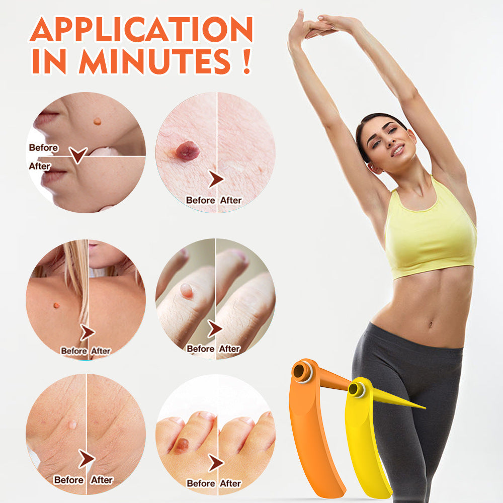 2 in 1 Skin Tag Removal Kit