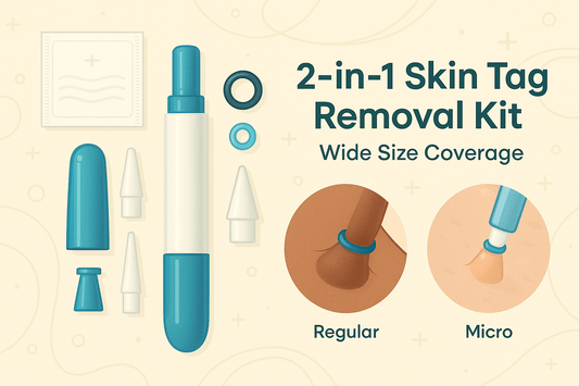 How to Remove Skin Tags at Home Safely – A Step-by-Step Guide