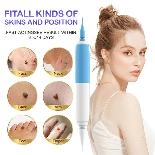 2-in-1 Skin Tag Removal Tool Skin Tag Falls Off Naturally