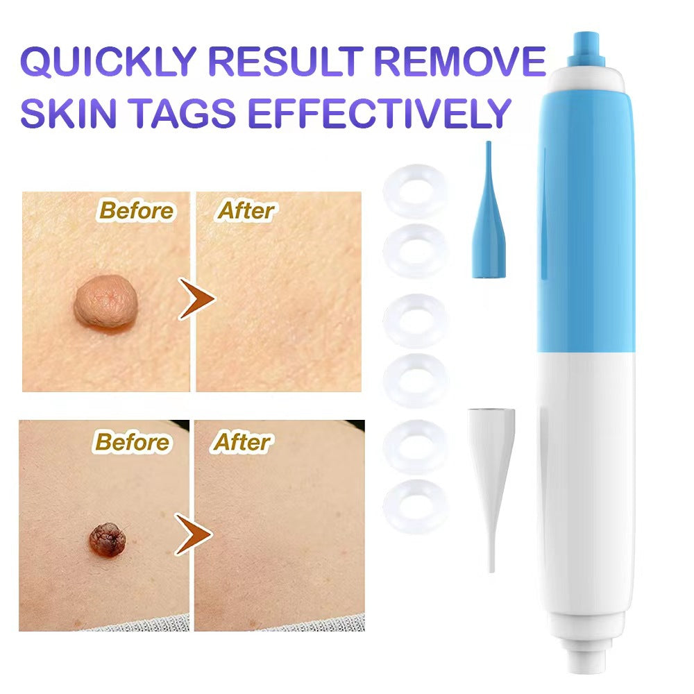 2-in-1 Skin Tag Removal Tool Skin Tag Falls Off Naturally