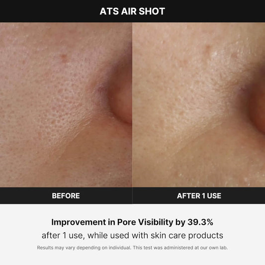Skin Care Anti-Wrinkle Device