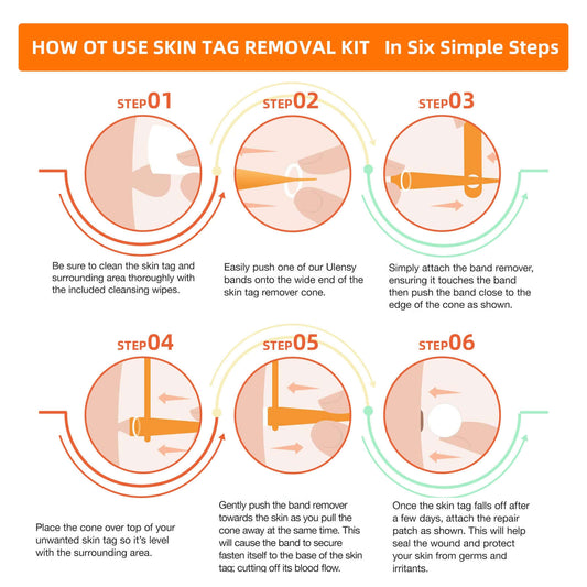 Skin Tag Remover Tool