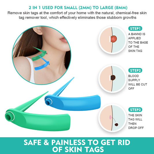 Skin Tag Remover Works On 2 to 8 mm Skin Tags